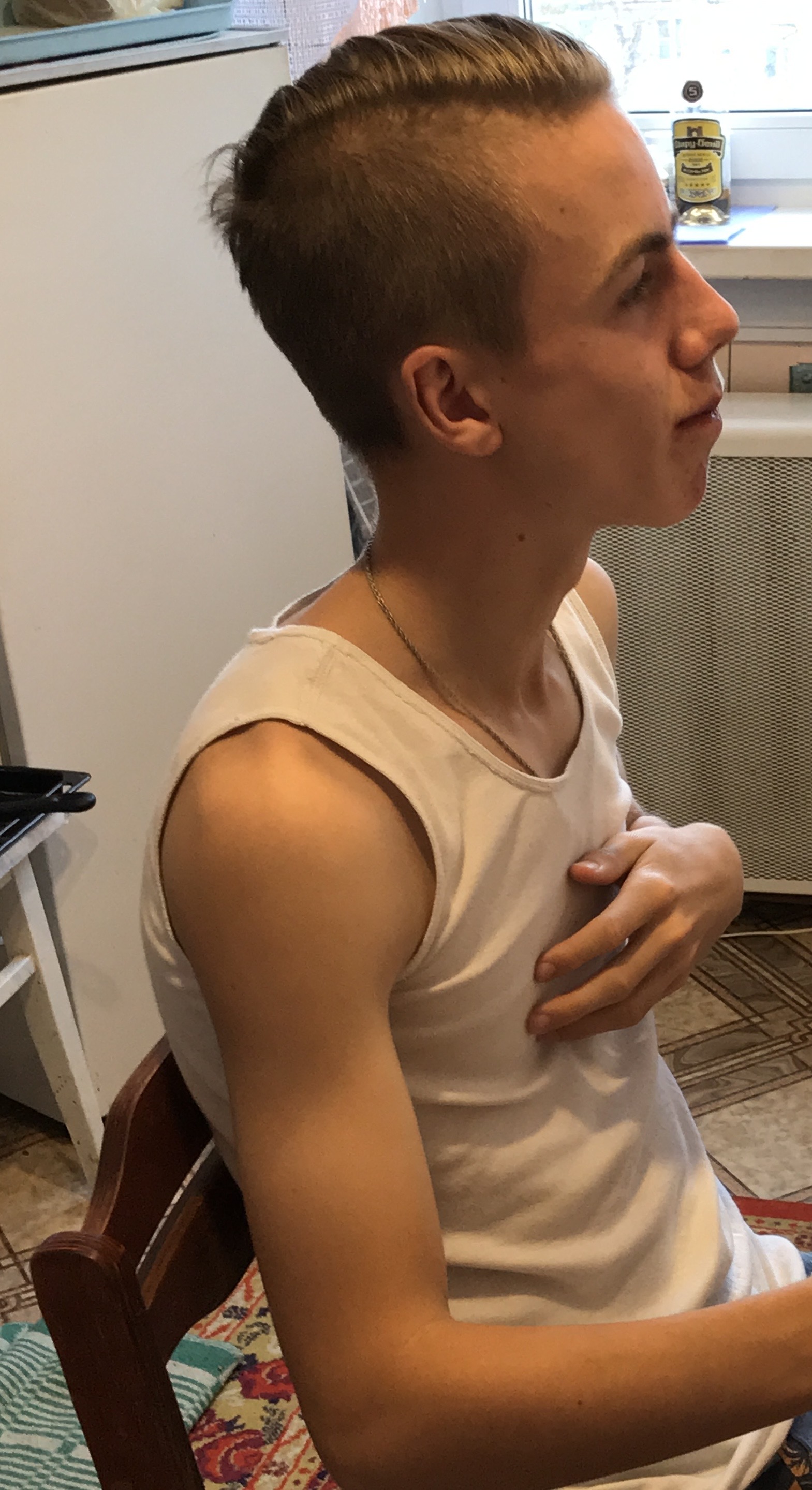 Arms like sticks